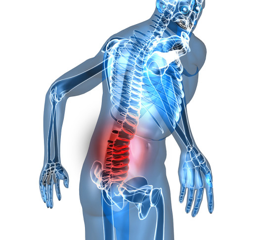 Epidurals-Relieve-Low-Back-Pain